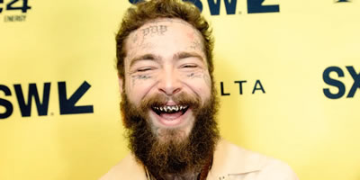 the dazzling smiles of famous singers: their investments in dental aesthetics
